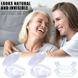 Perfect Snap On Smile